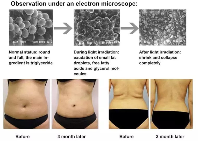 Observation Under An Electron Microscope