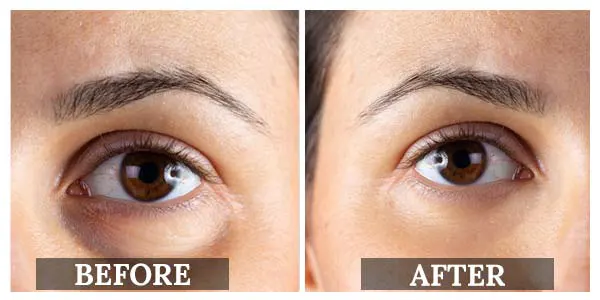 ajara eye cream before and after