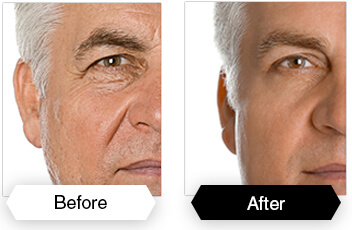 DermaSet Clinically Proven