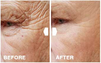 DermaSet Clinically Proven