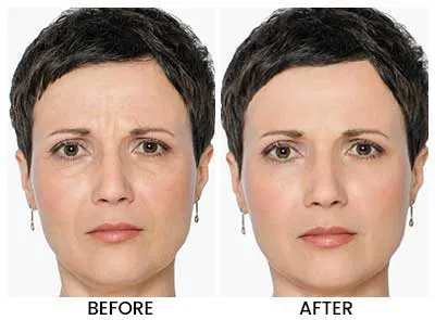 Dermal Repair Complex Before and After