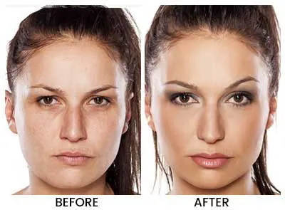 Dermal Repair Complex Before and After