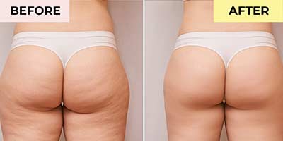 Life’s Butter Before and After