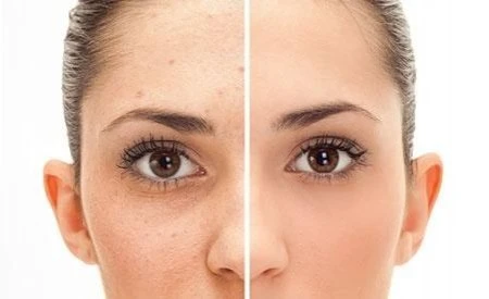 skingfix skin tags customer review